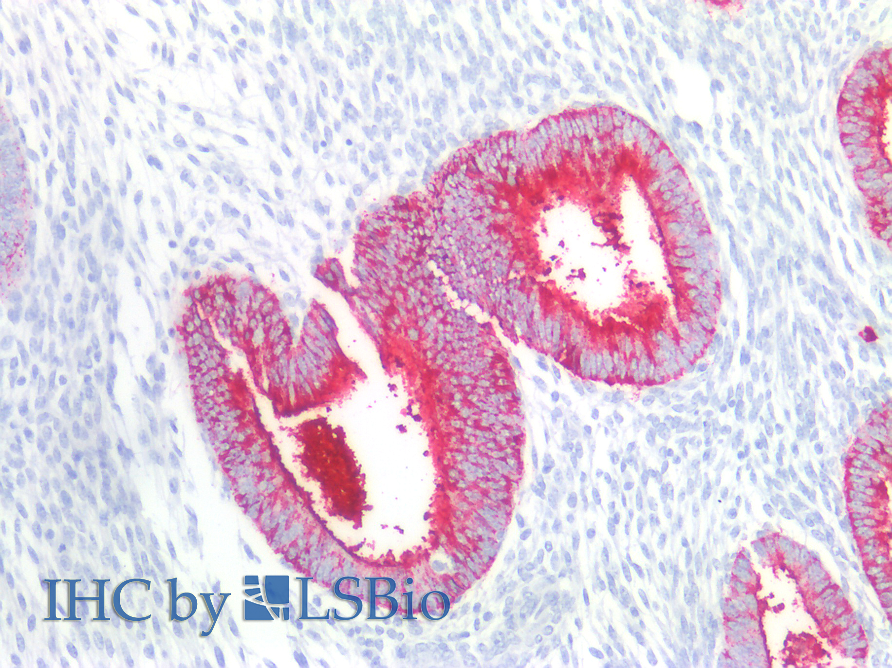 11-138_IHC