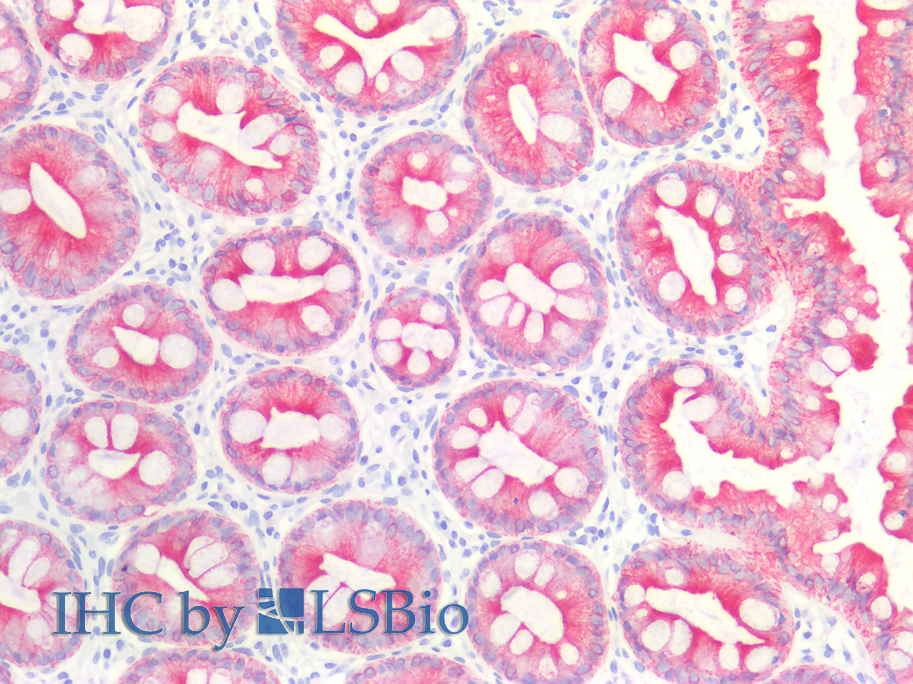 11-119_IHC