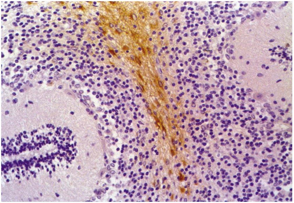 11-255_IHC