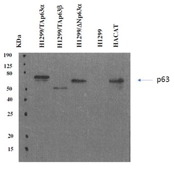 p63_WB.jpg