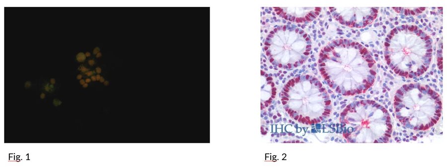 PCNA_1-2.jpg