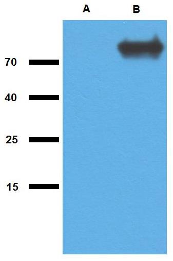 Anti-GlcB (M. tuberculosis) Purified