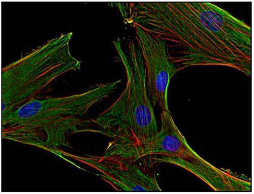 Anti-Clathrin Heavy Chain Purified