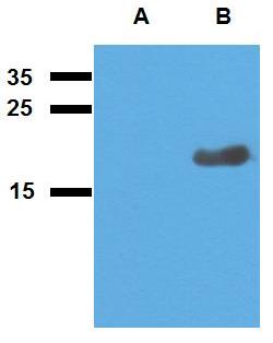 Anti-Acr2 (M. tuberculosis) Purified