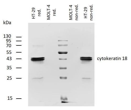 Anti-Cytokeratin 18 Biotin