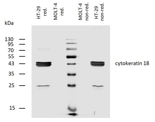 Anti-Cytokeratin 18 Biotin