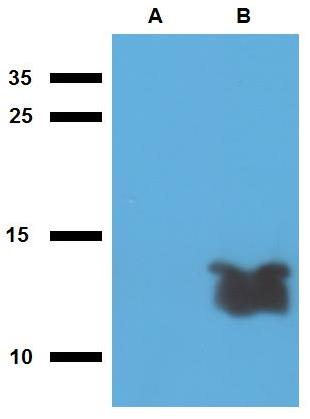 Anti-Tb7.7 (M. tuberculosis) Purified