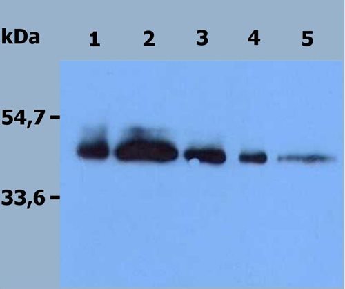 Recombinant human TRAIL-R1 (DR4)/Fc Chimera