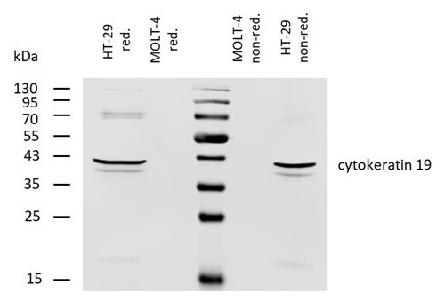 Anti-Cytokeratin 19 Biotin