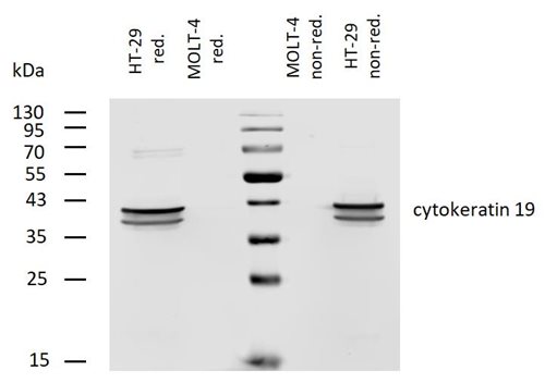 Anti-Cytokeratin 19 Biotin