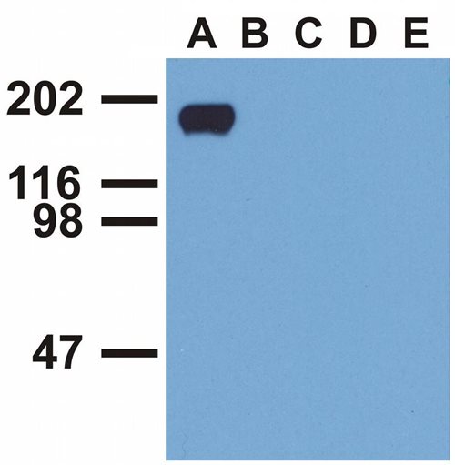 Anti-Hu EGFR (pY992) Purified