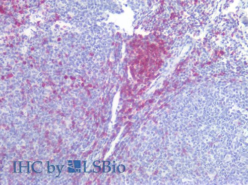 Anti-Hu CD5 Purified