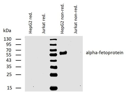 Anti-alpha-Fetoprotein Purified