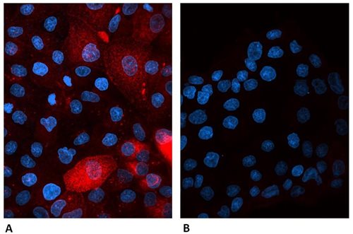 Anti-Hu beta2-Microglobulin Alexa Fluor<sup>®</sup> 647