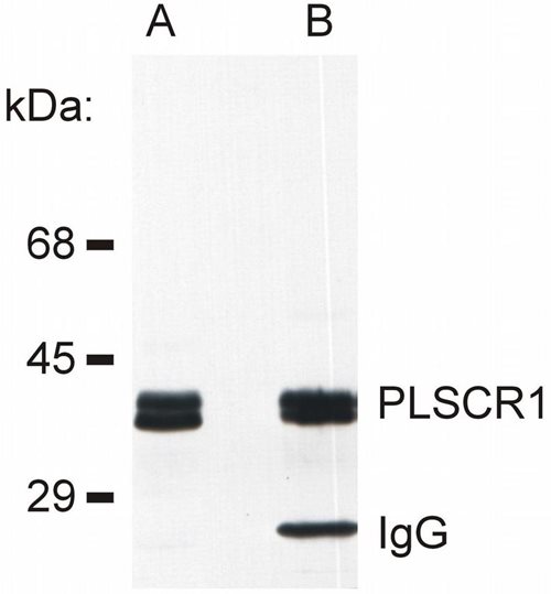 Anti-Rt PLSCR1 Ascites