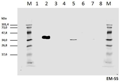 Anti-Hu CD3 zeta (pY111) Purified